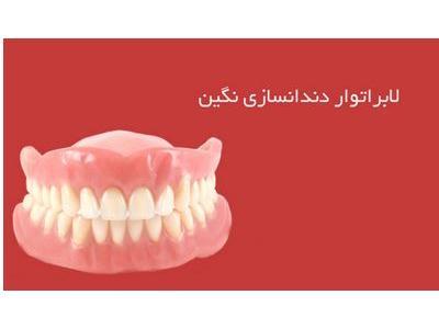  لابراتوار دندانسازی نگین در قزوین 